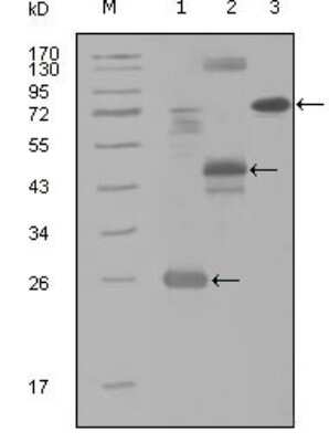 Western Blot: HGK/MAP4K4 Antibody (3C7B5) [NBP1-28855] - Western blot analysis using MAP4K4 mouse mAb against truncated Trx-MAP4K4 recombinant protein (1), MBP-MAP4K4 (aa300-400) recombinant protein (2) and MAP4K4(aa194-436)-hIgGFc transfected CH0-K1 cell lysate(3).