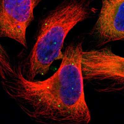 Immunocytochemistry/Immunofluorescence: HGS Antibody [NBP1-83202] - Staining of human cell line U-2 OS shows localization to cytosol & vesicles. Antibody staining is shown in green.