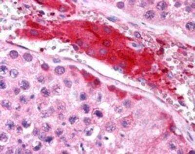 Immunohistochemistry-Paraffin: HGS Antibody [NB100-2839] - Immunohistochemical analysis of paraffin embedded Human Testis. Antibody at 2.5 ug/mL. Steamed antigen retrieval with citrate buffer pH 6, AP-staining. Staining shows strong signal of Leydig cells.