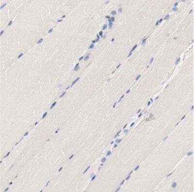 Immunohistochemistry-Paraffin: HGS Antibody [NBP1-83202] - Staining of human skeletal muscle shows no positivity in myocytes as expected.