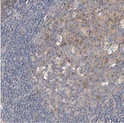 Immunohistochemistry-Paraffin: HGS Antibody [NBP1-83202] - Staining of human tonsil shows moderate cytoplasmic positivity in germinal center cells.