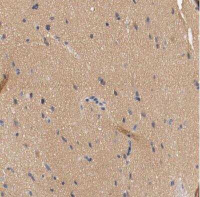 Immunohistochemistry-Paraffin: HGS Antibody [NBP1-83202] - Staining of human cerebral cortex shows moderate positivity in neuropil.