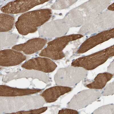 Immunohistochemistry-Paraffin: HGS Antibody [NBP1-83203] - Staining of human skeletal muscle shows strong cytoplasmic positivity in subsets of muscle fibers.