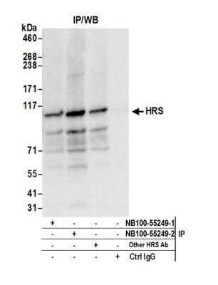 <b>Independent Antibodies Validation. </b>Immunoprecipitation: HGS Antibody [NB100-55249] - Detection of human HRS by western blot of immunoprecipitates. Samples: Whole cell lysate (0.5 or 1.0 mg per IP reaction; 20% of IP loaded) from HeLa cells prepared using NETN lysis buffer. Antibodies: Affinity purified rabbit anti-HRS antibody NB100-55249 (lot NB100-55249-2) used for IP at 6 ug per reaction. HRS was also immunoprecipitated by a previous lot of this antibody (NB100-55249-1) and another rabbit anti-HRS antibody. For blotting immunoprecipitated HRS, NB100-55249 was used at 0.4 ug/ml. Detection: Chemiluminescence with an exposure time of 3 seconds.