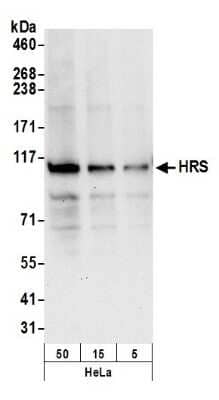 Western Blot: HGS Antibody [NB100-55249] - Detection of Human HRS by Western Blot. Samples: Whole cell lysate (50, 15, 5 ug) from HeLa cells prepared using NETN lysis buffer. Antibody: Affinity purified rabbit anti-HRS antibody NB100-55249 used for WB at 0.1 ug/ml. Detection: Chemiluminescence with an exposure time of 10 seconds.