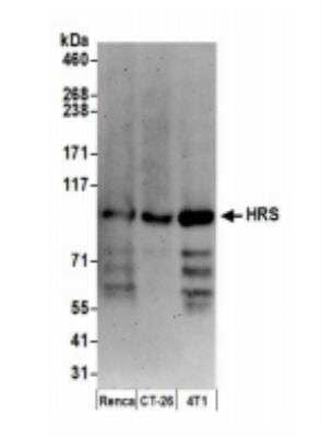 Western Blot: HGS Antibody [NB100-55249] - Whole cell lysate (15 ug) from Renca, CT26.WT and 4T1 cells prepared using NETN lysis buffer. Antibody: Affinity purified rabbit anti-HRS antibody used for WB at 0.1 ug/ml. Detection: Chemiluminescence with an exposure time of 3 minutes.