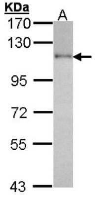 Western Blot: HGS Antibody [NBP2-16820] - Sample (30 ug of whole cell lysate) A: H1299 7. 5% SDS PAGE gel, diluted at 1:1000.