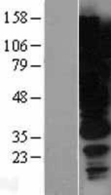 Western Blot: HGS Overexpression Lysate (Adult Normal) [NBP2-04275] Left-Empty vector transfected control cell lysate (HEK293 cell lysate); Right -Over-expression Lysate for HGS.