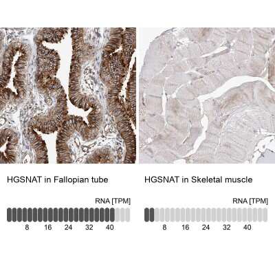 Immunohistochemistry-Paraffin: HGSNAT Antibody [NBP1-81990] - Analysis in human fallopian tube and skeletal muscle tissues. Corresponding HGSNAT RNA-seq data are presented for the same tissues.