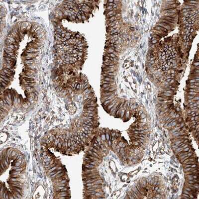 Immunohistochemistry-Paraffin: HGSNAT Antibody [NBP1-81990] - Staining of human Fallopian tube shows strong membranous positivity in glandular cells.