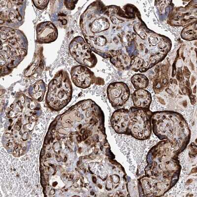 Immunohistochemistry-Paraffin: HGSNAT Antibody [NBP1-81990] - Staining of human placenta shows strong membranous positivity in trophoblastic cells.