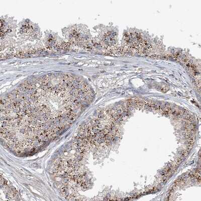 Immunohistochemistry-Paraffin: HGSNAT Antibody [NBP1-81990] - Staining of human prostate shows strong granular cytoplasmic positivity in glandular cells.