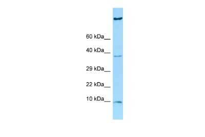 Western Blot: HGSNAT Antibody [NBP2-83038] - WB Suggested Anti-HGSNAT Antibody. Titration: 1.0 ug/ml. Positive Control: OVCAR-3 Whole CellHGSNAT is supported by BioGPS gene expression data to be expressed in OVCAR3