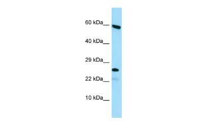 Western Blot: HGSNAT Antibody [NBP2-83039] - Host: Rabbit. Target Name: HGSNAT. Sample Type: HepG2 Whole Cell lysates. Antibody Dilution: 1.0ug/mlHGSNAT is supported by BioGPS gene expression data to be expressed in HepG2