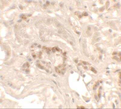 Immunohistochemistry HHATL Antibody - BSA Free