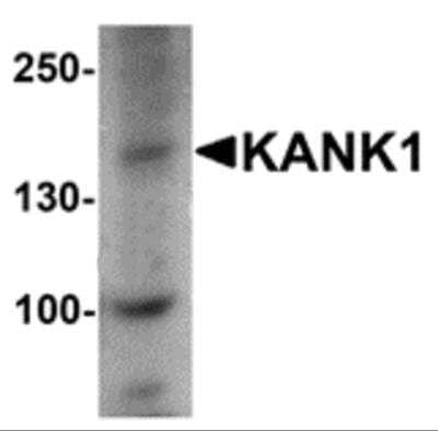 Western Blot HHATL Antibody - BSA Free