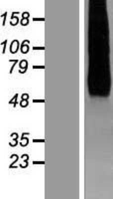 Western Blot HHATL Overexpression Lysate