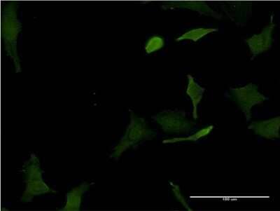 Immunocytochemistry/Immunofluorescence: HHEX Antibody (2C8) [H00003087-M12] - Analysis of monoclonal antibody to HHEX on HeLa cell. Antibody concentration 10 ug/ml