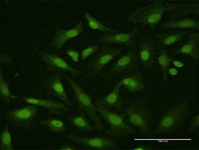 Immunocytochemistry/Immunofluorescence: HHEX Antibody [H00003087-B01P] - Analysis of purified antibody to HHEX on HeLa cell. (antibody concentration 10 ug/ml)