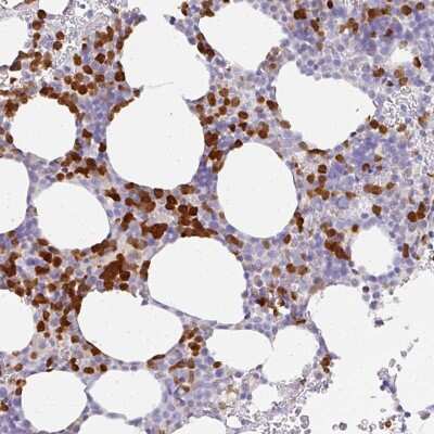 Immunohistochemistry-Paraffin: HHEX Antibody [NBP2-49024] - Staining of human bone marrow shows strong cytoplasmic positivity in hematopoietic cells.