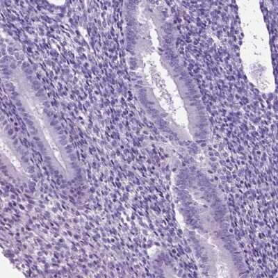 Immunohistochemistry-Paraffin HHIP-Like 2 Antibody