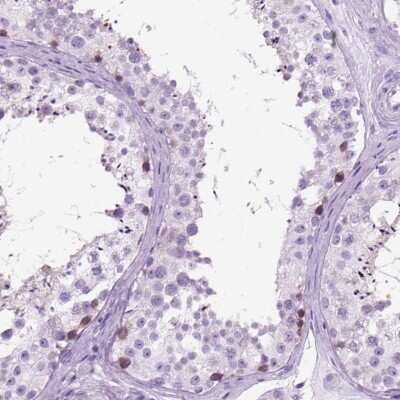 Immunohistochemistry-Paraffin HHIP-Like 2 Antibody