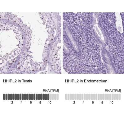 Immunohistochemistry-Paraffin HHIP-Like 2 Antibody