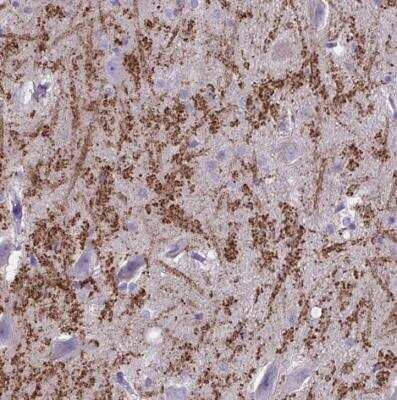 Immunohistochemistry-Paraffin: HHLA1 Antibody [NBP2-32420] - Staining of human hippocampus shows distinct extracellular positivity.