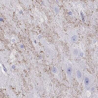 Immunohistochemistry-Paraffin: HHLA1 Antibody [NBP2-32420] - Staining of human hippocampus shows moderate granular positivity in synapses.