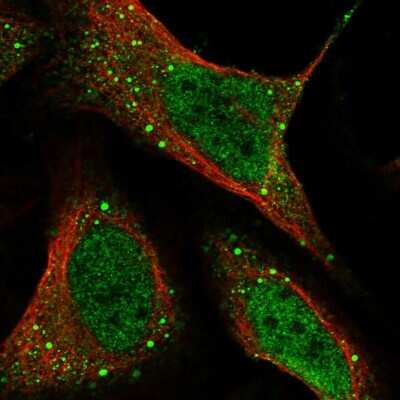 Immunocytochemistry/ Immunofluorescence HHLA3 Antibody