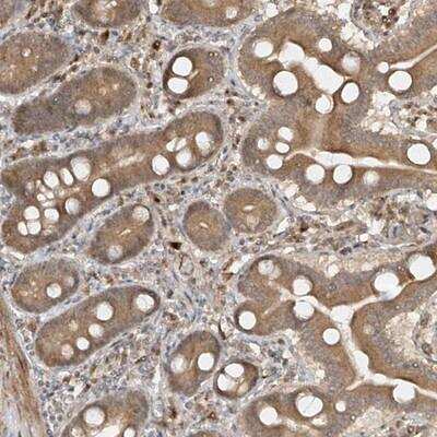 Immunohistochemistry-Paraffin HHLA3 Antibody