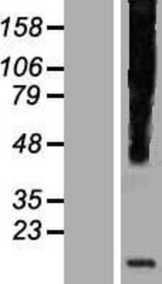 Western Blot: HHLA3 Overexpression Lysate (Adult Normal) [NBP2-08587] Left-Empty vector transfected control cell lysate (HEK293 cell lysate); Right -Over-expression Lysate for HHLA3.