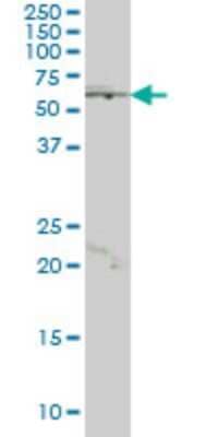 Western Blot: HHMJG Antibody (4E10) [H00008690-M01] - JRKL monoclonal antibody (M01), clone 4E10 Analysis of JRKL expression in K-562.