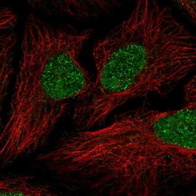 Immunocytochemistry/Immunofluorescence: HHMJG Antibody [NBP2-68760] - Staining of human cell line HeLa shows localization to nucleus.