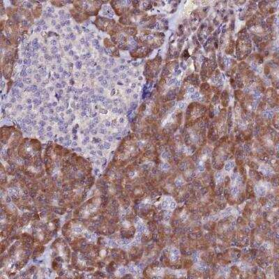 Immunohistochemistry-Paraffin: HHMJG Antibody [NBP1-91986] - Staining of human pancreas shows distinct cytoplasmic positivity in exocrine glandular cells.