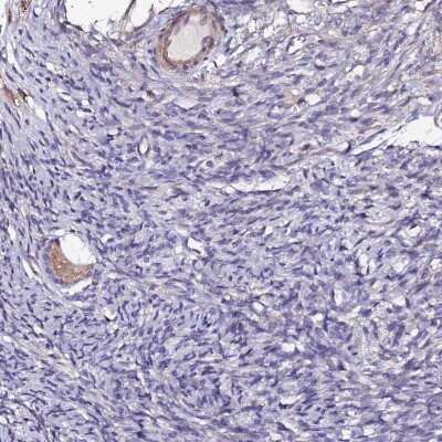 Immunohistochemistry-Paraffin: HHMJG Antibody [NBP1-91986] - Staining of human ovary shows moderate cytoplasmic positivity in follicle cells.