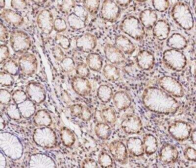 Immunohistochemistry-Paraffin: HHMJG Antibody [NBP3-12673] - Staining of human JRKL in human stomach with rabbit polyclonal antibody at 1:1000 dilution.