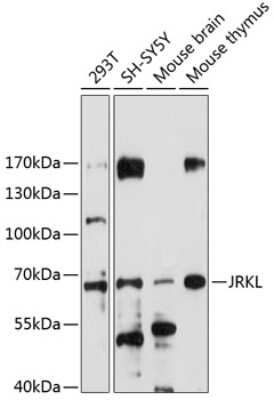 Western Blot: HHMJG Antibody [NBP3-03589] - Analysis of extracts of various cell lines, using HHMJG antibody at 1:1000 dilution. Secondary antibody: HRP Goat Anti-Rabbit IgG (H+L) at 1:10000 dilution. Lysates/proteins: 25ug per lane. Blocking buffer: 3% nonfat dry milk in TBST. Detection: ECL Enhanced Kit.