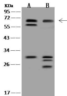 Western Blot: HHMJG Antibody [NBP3-12673] - Lane A: Jurkat Whole Cell LysateLane B: U-251MG Whole Cell LysateLysates/proteins at 30 ug per lane.SecondaryGoat Anti-Rabbit IgG (H+L)/HRP at 1/10000 dilution.Developed using the ECL technique.Performed under reducing conditions.Predicted band size:60 kDaObserved band size:70 kDa(We are unsure as to the identity of these extra bands.)