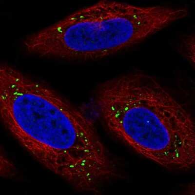 Immunocytochemistry/ Immunofluorescence HIAT1 Antibody