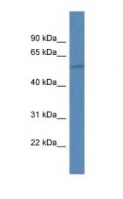 Western Blot HIATL1 Antibody