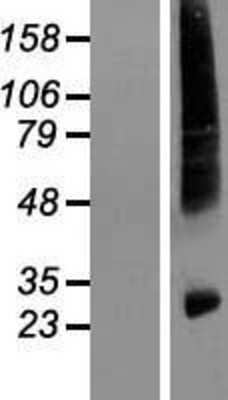 Western Blot: HIATL1 Overexpression Lysate (Adult Normal) [NBL1-11536] Left-Empty vector transfected control cell lysate (HEK293 cell lysate); Right -Over-expression Lysate for HIATL1.