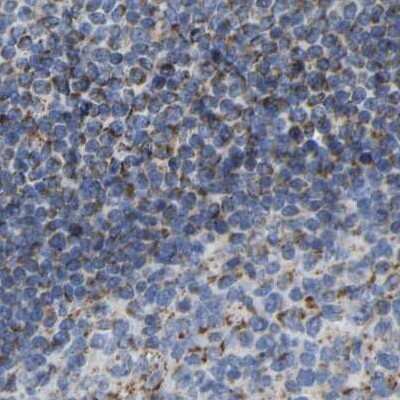 Immunohistochemistry-Paraffin: HIBADH Antibody [NBP1-80985] - Staining of human lymph node.