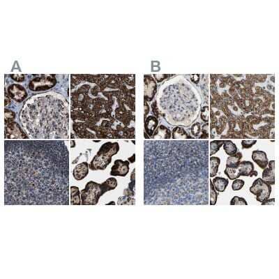 Immunohistochemistry-Paraffin HIBADH Antibody - BSA Free