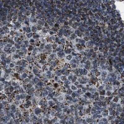 Immunohistochemistry-Paraffin HIBADH Antibody - BSA Free