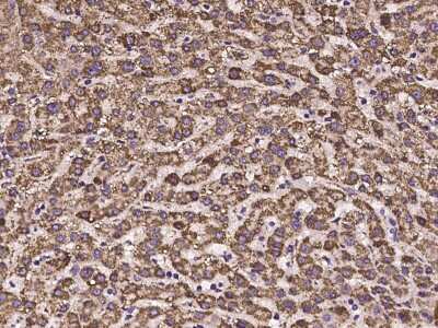 Immunohistochemistry-Paraffin: HIBADH Antibody [NBP2-97223] - Immunochemical staining of human HIBADH in human liver with rabbit polyclonal antibody at 1:100 dilution, formalin-fixed paraffin embedded sections.