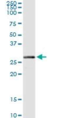 Western Blot: HIBADH Antibody [H00011112-D01P] - Analysis of HIBADH expression in mouse kidney.