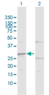 Western Blot: HIBADH Antibody [H00011112-D01P] - Analysis of HIBADH expression in transfected 293T cell line by HIBADH polyclonal antibody.Lane 1: HIBADH transfected lysate(35.30 KDa).Lane 2: Non-transfected lysate.