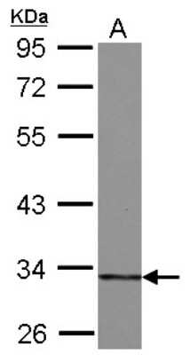 Western Blot: HIBADH Antibody [NBP2-16827] - Sample (30 ug of whole cell lysate) A: A549 10% SDS PAGE gel, diluted at 1:5000.