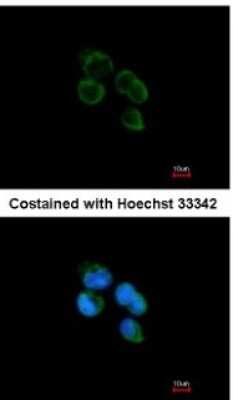 Immunocytochemistry/Immunofluorescence: HIBCH Antibody [NBP1-32964] - Analysis of methanol-fixed A431, using antibody at 1:200 dilution.